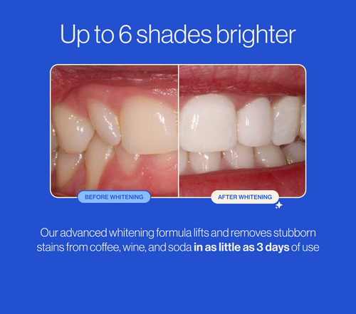 Autobrush® Whitening Tray